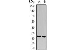 Western blot analysis of FBXO22 expression in Hela (A), MCF7 (B) whole cell lysates. (FBXO22 抗体)