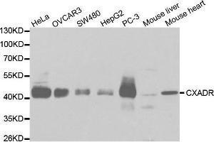 Western Blotting (WB) image for anti-Coxsackie Virus and Adenovirus Receptor (CXADR) antibody (ABIN1872126) (Coxsackie Adenovirus Receptor 抗体)