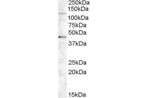 Western Blotting (WB) image for anti-Tankyrase, TRF1-Interacting Ankyrin-Related ADP-Ribose Polymerase 2 (TNKS2) (Internal Region) antibody (ABIN2466779) (TNKS2 抗体  (Internal Region))