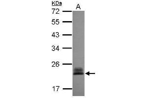 WB Image Sample (30 ug of whole cell lysate) A: A431 , 12% SDS PAGE antibody diluted at 1:3000 (RHOC 抗体)
