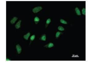 Immunostaining analysis in HeLa cells. (GATAD1 抗体)
