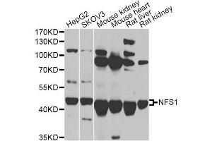 Western blot analysis of extracts of various cell lines, using NFS1 antibody. (NFS1 抗体)