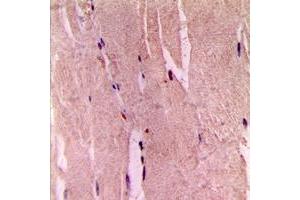 Immunohistochemical analysis of GYS1 (pS645) staining in human skeletal muscle formalin fixed paraffin embedded tissue section. (Glycogen Synthase 1 抗体  (C-Term, pSer645))