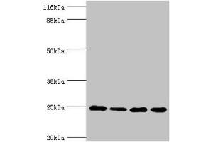 Western blot All lanes: NDUFA13 antibody at 3. (NDUFA13 抗体  (AA 52-144))