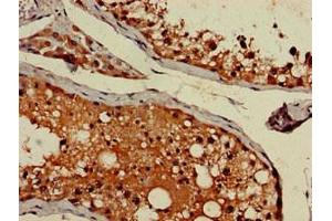 Immunohistochemistry (IHC) image for anti-Adaptor-Related Protein Complex 1, gamma 1 Subunit (AP1G1) (AA 592-686) antibody (ABIN7144346)
