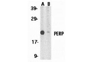 Western Blotting (WB) image for anti-TP53 Apoptosis Effector (PERP) (C-Term) antibody (ABIN1030575) (PERP 抗体  (C-Term))
