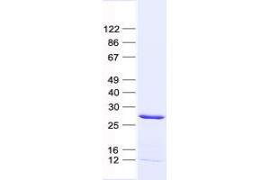 Western Blotting (WB) image for Udp-N-Acetyl-alpha-D-Galactosamine:polypeptide N-Acetylgalactosaminyltransferase 9 (GalNAc-T9) (GALNT9) protein (His tag) (ABIN2721666)