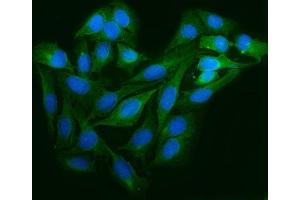 IF analysis of Astrin/Deepest/SPAG5 using anti-Astrin/Deepest/SPAG5 antibody (ABIN7602399). (SPAG5 抗体  (AA 738-1193))