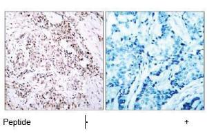Image no. 1 for anti-Estrogen Receptor 1 (ESR1) (Ser106) antibody (ABIN197216)