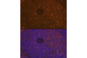 Immunofluorescence analysis of rat spleen using CD35/CR1 Rabbit mAb (ABIN7266477) at dilution of 1:100 (40x lens). (CD35 抗体)