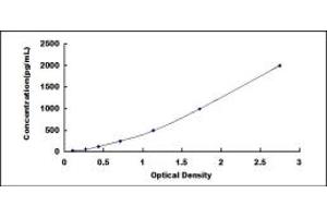 Typical standard curve (IL1R1 ELISA 试剂盒)