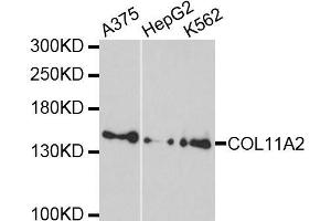 Western Blotting (WB) image for anti-Collagen, Type XI, alpha 2 (COL11A2) (AA 210-380) antibody (ABIN6138835)