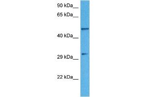 Western Blotting (WB) image for anti-Tryptophan 2,3-Dioxygenase (TDO2) (N-Term) antibody (ABIN2782334)