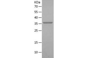 Western Blotting (WB) image for Glutathione Peroxidase 4 (GPX4) (AA 74-179) protein (His-IF2DI Tag) (ABIN7123131) (GPX4 Protein (AA 74-179) (His-IF2DI Tag))