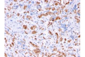 Formalin-fixed, paraffin-embedded human Placenta stained with Spectrin alpha 1 Mouse Recombinant Monoclonal Antibody (rSPTA1/1832). (Recombinant SPTA1 抗体  (AA 356-475))