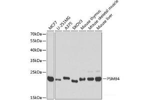 Western blot analysis of extracts of various cell lines using PSMB4 Polyclonal Antibody at dilution of 1:1000. (PSMB4 抗体)