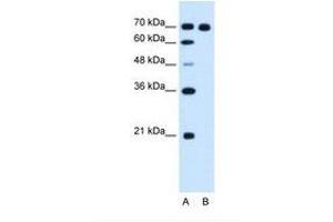 Image no. 1 for anti-Ribonucleotide Reductase M1 (RRM1) (AA 723-772) antibody (ABIN321011) (RRM1 抗体  (AA 723-772))