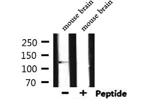 Western blot analysis of extracts from mouse brain, using E-cadherin Antibody. (E-cadherin 抗体  (C-Term))