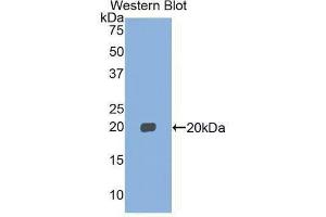 Western Blotting (WB) image for anti-Myosin, Light Chain 2, Regulatory, Cardiac, Slow (MYL2) (AA 2-159) antibody (ABIN1859939) (MYL2 抗体  (AA 2-159))