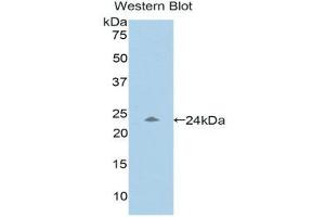 Western Blotting (WB) image for anti-Pregnancy Zone Protein (PZP) (AA 1212-1391) antibody (ABIN1176525) (PZP 抗体  (AA 1212-1391))