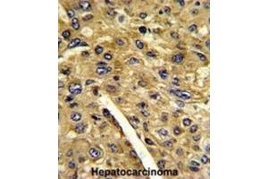 Immunohistochemistry (IHC) image for anti-Aminomethyltransferase (AMT) antibody (ABIN3002783) (Aminomethyltransferase 抗体)