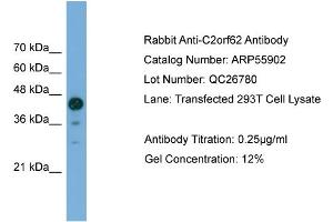 WB Suggested Anti-C2orf62  Antibody Titration: 0. (C2orf62 抗体  (C-Term))