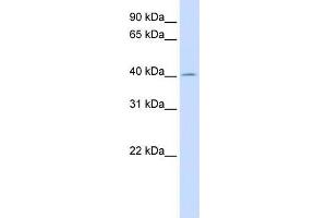 Human Liver; WB Suggested Anti-ACAA2 Antibody Titration: 0. (ACAA2 抗体  (N-Term))