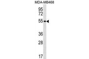Western Blotting (WB) image for anti-Zinc Finger Protein 621 (ZNF621) antibody (ABIN3000262) (ZNF621 抗体)