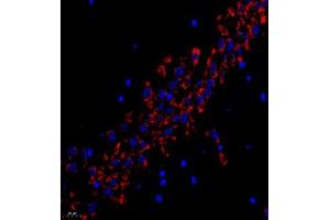 Immunofluorescence (Paraffin-embedded Sections) (IF (p)) image for anti-Ribosomal Protein L10L (RPL10L) antibody (ABIN7075429)