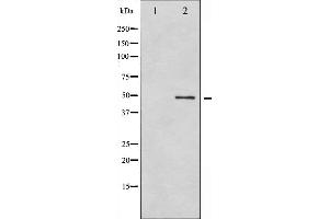 Western blot analysis of GFAP phosphorylation expression in HeLa whole cell lysates,The lane on the left is treated with the antigen-specific peptide. (GFAP 抗体  (pSer38))
