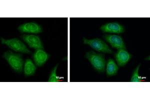 ICC/IF Image FASTKD1 antibody [C1C3] detects FASTKD1 protein at cytoplasm by immunofluorescent analysis. (FASTKD1 抗体)