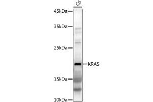 Western blot analysis of extracts of C6 cells, using KRAS antibody (ABIN3021676, ABIN3021677, ABIN3021678, ABIN1513137 and ABIN1514282) at 1:1000 dilution. (K-RAS 抗体)