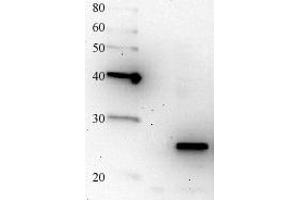 Western Blotting (WB) image for anti-Nas6/p28 antibody (ABIN2452055)