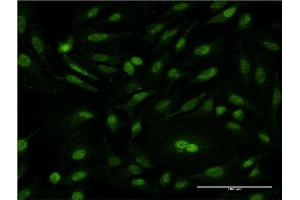Immunofluorescence of monoclonal antibody to CSE1L on HeLa cell. (Exportin 2 抗体  (AA 872-971))