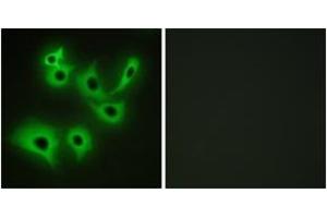 Immunofluorescence analysis of A549 cells, using CDH4 Antibody. (Cadherin 4 抗体  (AA 731-780))