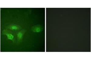 Immunofluorescence analysis of HepG2 cells, using HDAC6 (Phospho-Ser22) Antibody.