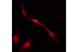 ABIN6267655 staining HuvEc by IF/ICC. (MED1 抗体  (pThr1457))