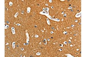 The image on the left is immunohistochemistry of paraffin-embedded Human brain tissue using ABIN7128257(ADD2 Antibody) at dilution 1/15, on the right is treated with fusion protein. (ADD2 抗体)