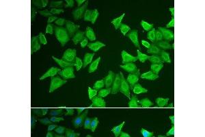 Immunofluorescence analysis of HeLa cells using ALAS2 Polyclonal Antibody (ALAS2 抗体)