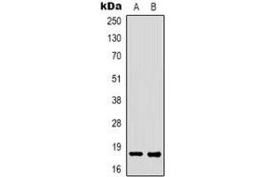 Western blot analysis of FAT10 expression in K562 (A), HEK293T (B) whole cell lysates. (UBD 抗体)