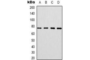 Western blot analysis of CEP76 expression in SKOV3 (A), HT29 (B), HepG2 (C), NIH3T3 (D) whole cell lysates. (Cep76 抗体)
