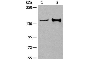 Western blot analysis of Hela and A172 cell lysates using CAPN15 Polyclonal Antibody at dilution of 1:400 (Calpain 15/SOLH 抗体)