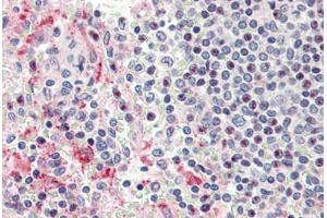 Human Spleen (formalin-fixed, paraffin-embedded) stained with HPSE antibody ABIN337167 at 5 ug/ml followed by biotinylated goat anti-rabbit IgG secondary antibody ABIN481713, alkaline phosphatase-streptavidin and chromogen. (HPSE 抗体)