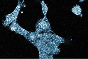 Immunofluorescence staining of A431cells (Human epithelial carcinoma, ATCC CRL-1555) with the mouse anti-GIT1 antibody. (GIT1 抗体  (AA 664-770))