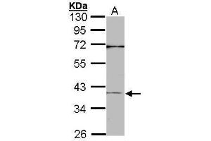 WB Image Sample (30 ug of whole cell lysate) A: A431 , 10% SDS PAGE antibody diluted at 1:1000 (CEBPB 抗体  (N-Term))