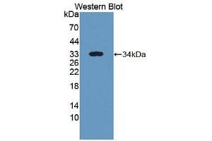 Western blot analysis of the recombinant protein. (ICK 抗体  (AA 1-284))