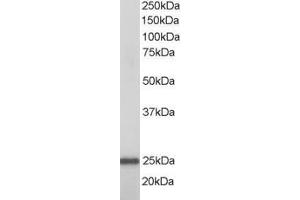 ABIN185256 staining (1µg/ml) of A431 lysate (RIPA buffer, 35µg total protein per lane). (RAN 抗体  (N-Term))