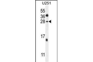 GGTLC2 Antibody (Center) (ABIN654174 and ABIN2844032) western blot analysis in  cell line lysates (35 μg/lane). (GGTLC2 抗体  (AA 127-154))
