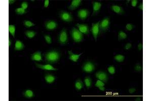 Immunofluorescence of monoclonal antibody to MAPK9 on HeLa cell. (JNK2 抗体  (AA 321-424))