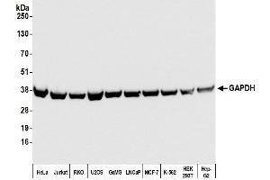 Western Blotting (WB) image for anti-Glyceraldehyde-3-Phosphate Dehydrogenase (GAPDH) (AA 225-275) antibody (ABIN7449428) (Recombinant GAPDH 抗体  (AA 225-275))